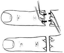 wan5902a75f6c62b2.17293803.jpg wan5902a75f6c62b2.17293803.jpg