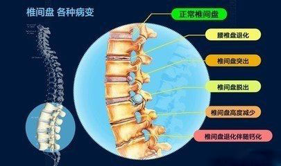 腰椎 腰椎