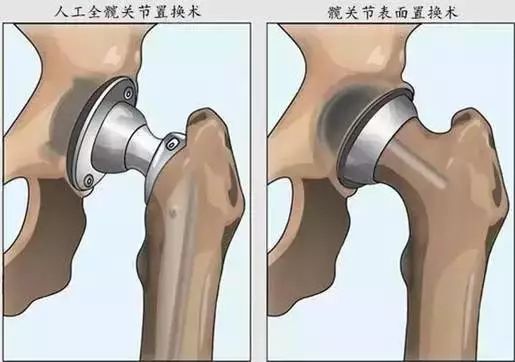 置换1.jpg 置换1.jpg