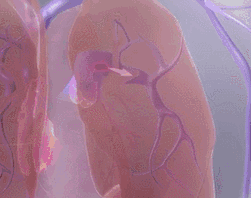 2.gif 2.gif